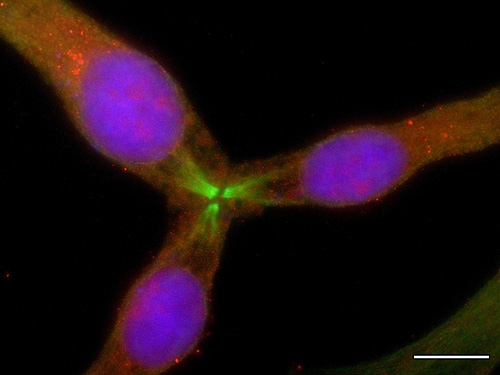 Fluorescence microscopy image showing a ternary telophase in NZM12
